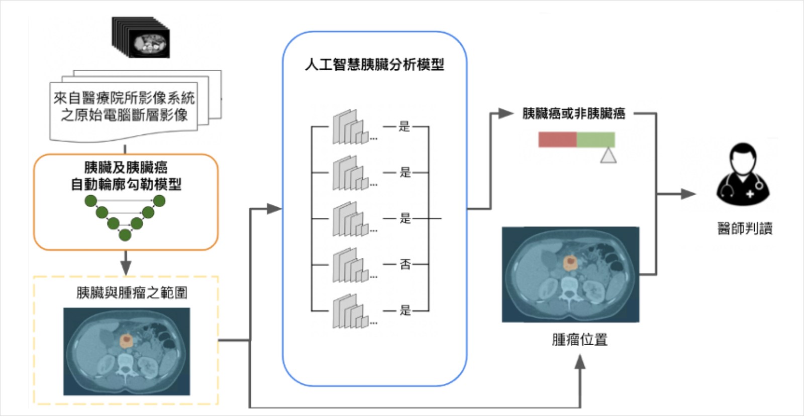 胰臟癌-癌症-醫療-臺大醫院-電腦斷層-PANCREASaver-助胰見-廖偉智