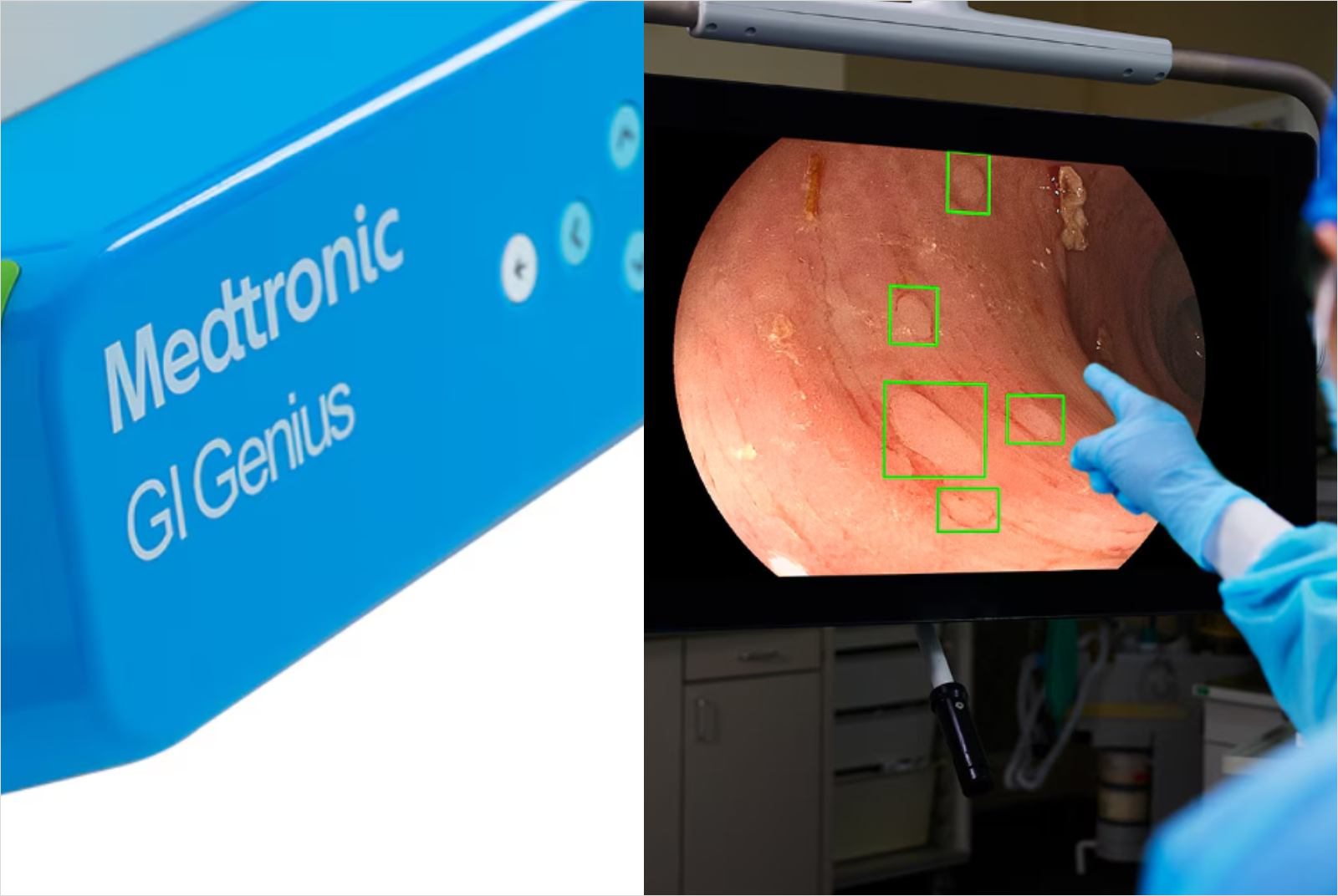 永齡基金會-大腸鏡-AI-大腸癌-息肉-Medtronic-NVIDIA-AI應用-AI醫療